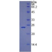 SDS-PAGE analysis of Human RBP4 Protein.