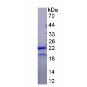 SDS-PAGE analysis of recombinant Human Retinol-Binding Protein 4 (RBP4) protein.