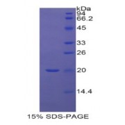 SDS-PAGE analysis of Human RBP5 Protein.