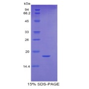 SDS-PAGE analysis of Human RBP5 Protein.