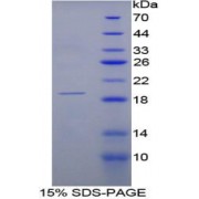 SDS-PAGE analysis of Rat RNASE3 Protein.
