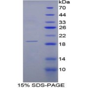 SDS-PAGE analysis of Rat RNASE3 Protein.