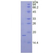 SDS-PAGE analysis of Human Ribonuclease A7 Protein.