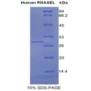 SDS-PAGE analysis of Human Ribonuclease L Protein.