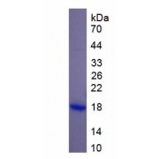 SDS-PAGE analysis of Human Ribophorin I Protein.