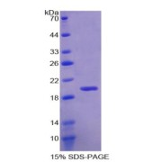 SDS-PAGE analysis of Human RBM20 Protein.