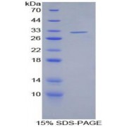 SDS-PAGE analysis of Human S Antigen Protein.