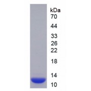 SDS-PAGE analysis of recombinant Human S100A10.