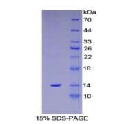 SDS-PAGE analysis of Human S100A11 Protein.