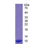 SDS-PAGE analysis of Human S100A12 Protein.