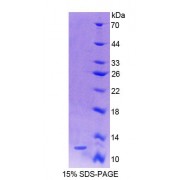 SDS-PAGE analysis of recombinant Human S100A4 Protein.