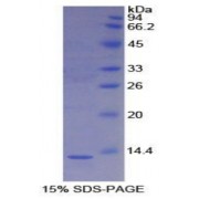 SDS-PAGE analysis of recombinant Mouse S100A4 Protein.