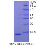 SDS-PAGE analysis of Cow S100A4 Protein.