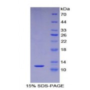 SDS-PAGE analysis of Human S100A5 Protein.