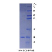 SDS-PAGE analysis of recombinant Rat Protein S100-A8 / CAGA (S100A8) Protein.