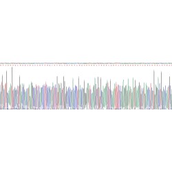 Human Protein S100-A9 / CAGB (S100A9) Protein