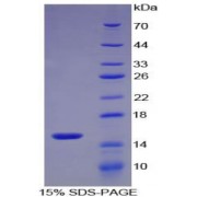 SDS-PAGE analysis of recombinant Mouse S100A9 Protein.