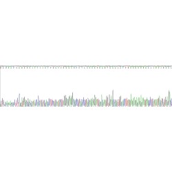 Mouse Protein S100-A9 / CAGB (S100A9) Protein