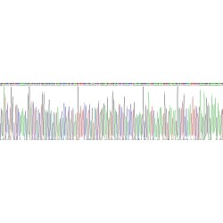 Rat Protein S100-A9 / CAGB (S100A9) Protein