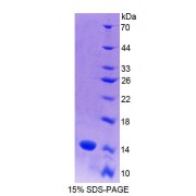 SDS-PAGE analysis of recombinant Rat S100A9 Protein.