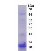 SDS-PAGE analysis of Human S100P Protein.