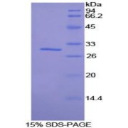 SDS-PAGE analysis of Mouse SIK2 Protein.