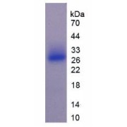 SDS-PAGE analysis of Mouse SOSTDC1 Protein.