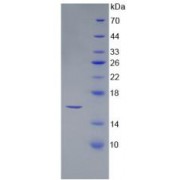 SDS-PAGE analysis of recombinant Human SFRP5 Protein.