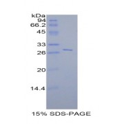 SDS-PAGE analysis of Rat Selectin, Leukocyte Protein.