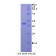 SDS-PAGE analysis of Human SELENBP1 Protein.