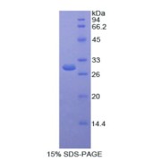 SDS-PAGE analysis of Human SELENBP1 Protein.