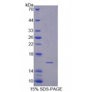 SDS-PAGE analysis of Human Semaphorin 3C Protein.