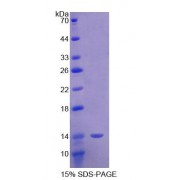 SDS-PAGE analysis of recombinant Mouse Semaphorin 3E Protein.