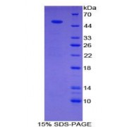 SDS-PAGE analysis of recombinant Human Semaphorin 4B Protein.