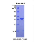 SDS-PAGE analysis of Rat Serum Amyloid P Component Protein.