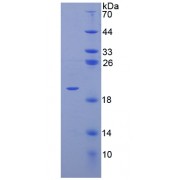 SDS-PAGE analysis of Human SIGLEC9 Protein.