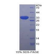 SDS-PAGE analysis of Human STAT1 Protein.