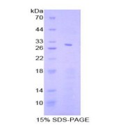 SDS-PAGE analysis of Human STAT4 Protein.