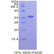 SDS-PAGE analysis of recombinant Rat STAT6 Protein.