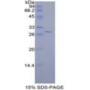 SDS-PAGE analysis of recombinant Mouse STAT6 Protein.