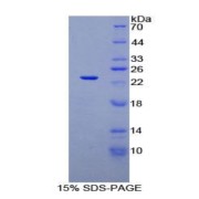 SDS-PAGE analysis of Rat SIT1 Protein.