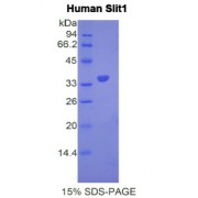 SDS-PAGE analysis of Human Slit Homolog 1 Protein.