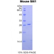 SDS-PAGE analysis of Mouse Slit Homolog 1 Protein.