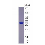 SDS-PAGE analysis of Human Slit Homolog 2 Protein.