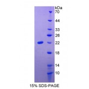 SDS-PAGE analysis of recombinant Human Slit Homolog 3 Protein.