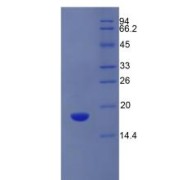 SDS-PAGE analysis of Human SLC3A2 Protein.