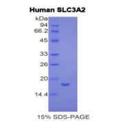 SDS-PAGE analysis of Human SLC3A2 Protein.