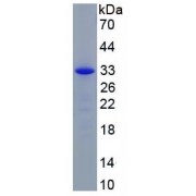 SDS-PAGE analysis of recombinant Human SLC30A8 Protein.