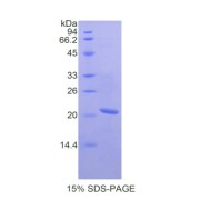SDS-PAGE analysis of Mouse SERPINB4 Protein.