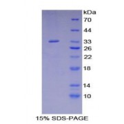 SDS-PAGE analysis of Human SHB Protein.